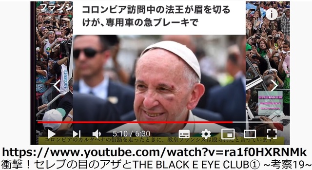 Pedoferia_of_world_famous_19.jpg