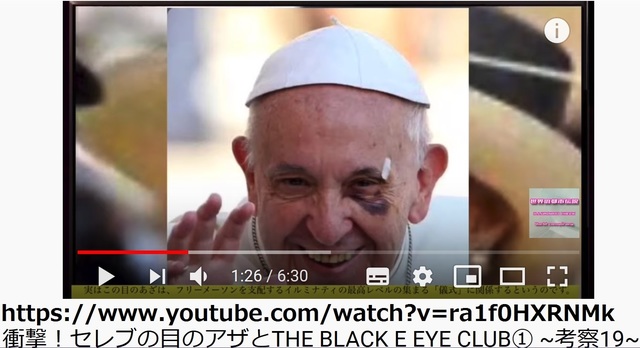 Pedoferia_of_world_famous_8.jpg